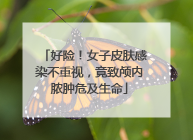 好险！女子皮肤感染不重视，竟致颅内脓肿危及生命