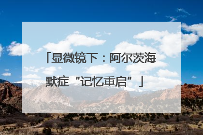 显微镜下：阿尔茨海默症“记忆重启”